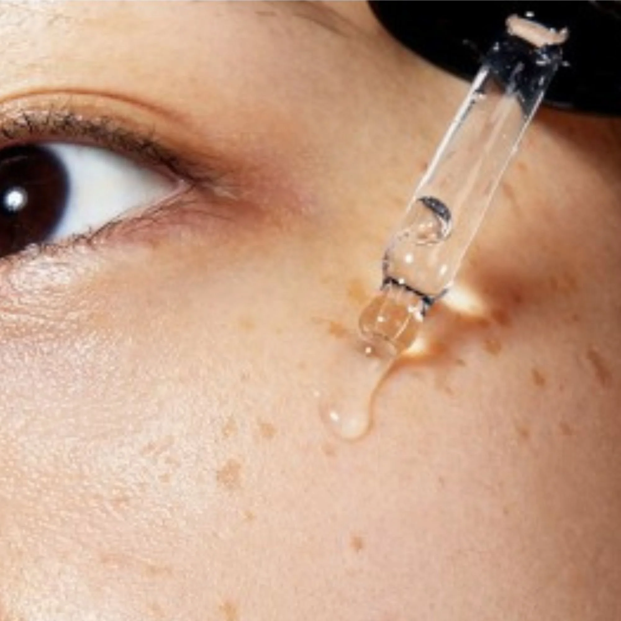 Gros plan de la peau recevant une goutte de sérum transparent. Application d'un sérum K-Beauty pour le visage à l'aide d'un compte-gouttes.