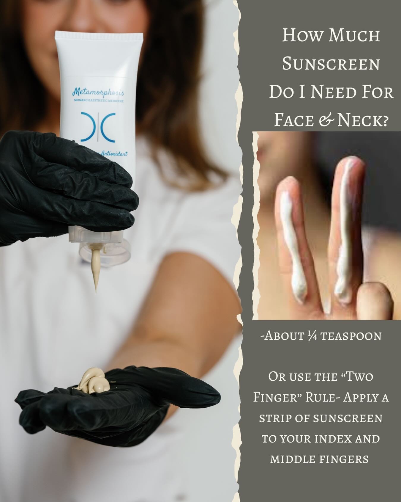 The two biggest mistakes patients make with sunscreen?

1. Not applying enough 🧴
2. Not reapplying ⏰

You need about 1/4 tsp of sunscreen to properly protect your face and neck. 
-An easy way to visualize this is to apply a strip of sunscreen along 