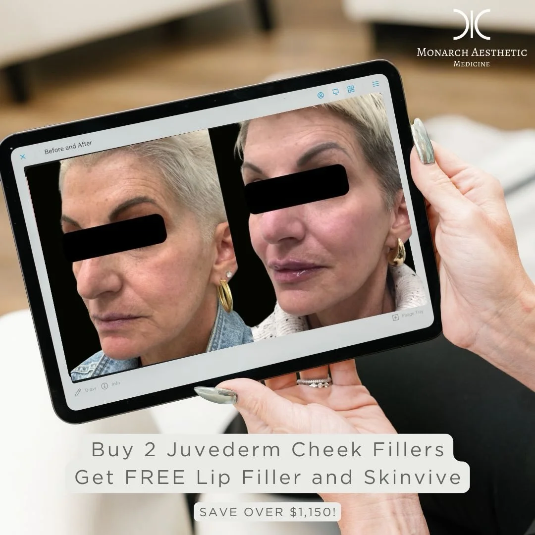 𝘑𝘶𝘴𝘵 𝘢 𝘭𝘪𝘵𝘵𝘭𝘦 𝘧𝘪𝘭𝘭𝘦𝘳 𝘮𝘢𝘨𝘪𝘤 𝘧𝘰𝘳 𝘵𝘩𝘢𝘵 𝘴𝘤𝘶𝘭𝘱𝘵𝘦𝘥 𝘢𝘯𝘥 𝘳𝘦𝘧𝘳𝘦𝘴𝘩𝘦𝘥 𝘨𝘭𝘰𝘸! ✨

𝗗𝗼𝗻&rsquo;𝘁 𝗺𝗶𝘀𝘀 𝗼𝘂𝘁 𝗼𝗻 𝗼𝘂𝗿 𝗔𝗽𝗿𝗶𝗹 𝗝𝘂𝘃𝗲𝗱𝗲𝗿𝗺 𝗖𝗵𝗲𝗲𝗸 𝗙𝗶𝗹𝗹𝗲𝗿𝘀 𝗦𝗽𝗲𝗰𝗶𝗮𝗹!
Buy 2 Juvederm 