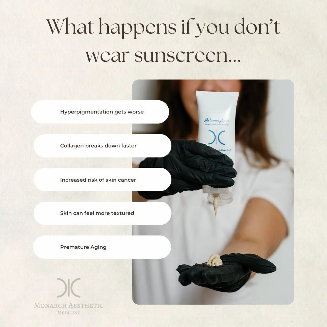 𝐏𝐫𝐨𝐭𝐞𝐜𝐭 𝐲𝐨𝐮𝐫 𝐬𝐤𝐢𝐧, 𝐩𝐫𝐞𝐬𝐞𝐫𝐯𝐞 𝐲𝐨𝐮𝐫 𝐠𝐥𝐨𝐰! 🌞 𝐒𝐮𝐧𝐬𝐜𝐫𝐞𝐞𝐧 𝐢𝐬 𝐲𝐨𝐮𝐫 𝐝𝐚𝐢𝐥𝐲 𝐬𝐡𝐢𝐞𝐥𝐝 𝐚𝐠𝐚𝐢𝐧𝐬𝐭 𝐡𝐚𝐫𝐦𝐟𝐮𝐥 𝐔𝐕 𝐫𝐚𝐲𝐬, 𝐫𝐞𝐝𝐮𝐜𝐢𝐧𝐠 𝐭𝐡𝐞 𝐫𝐢𝐬𝐤 𝐨𝐟 𝐬𝐤𝐢𝐧 𝐜𝐚𝐧𝐜𝐞𝐫 𝐚𝐧𝐝 𝐩𝐫𝐞𝐦