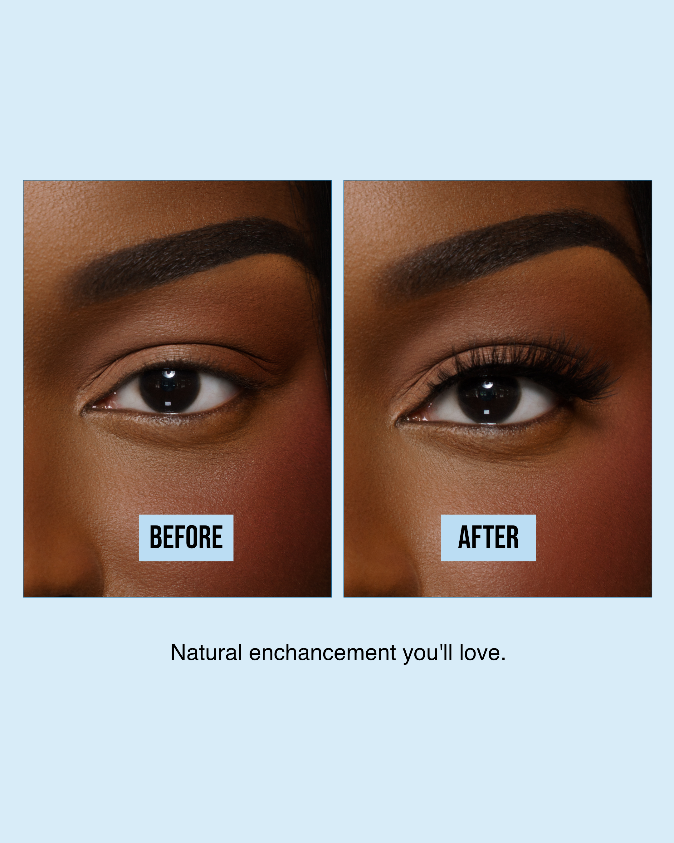 before:after.png