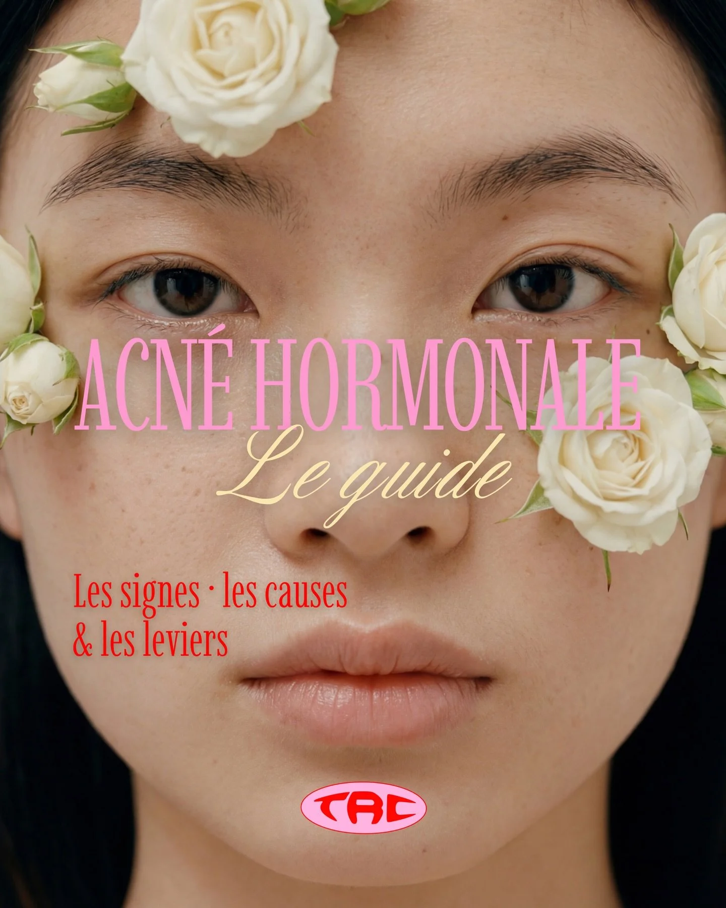 L&rsquo;acn&eacute; hormonale n&rsquo;est pas un probl&egrave;me de peau. C&rsquo;est un signal d&rsquo;un d&eacute;s&eacute;quilibre hormonal plus profond.

Quand les androg&egrave;nes sont en exc&egrave;s, que le cortisol s&rsquo;emballe, que l&rsq