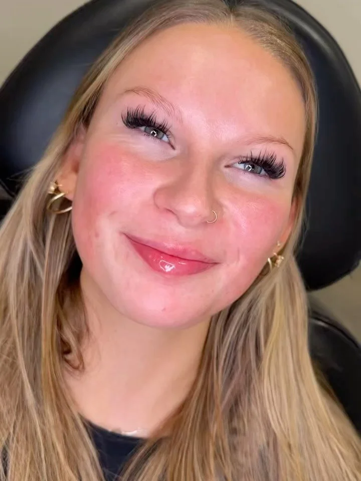 Natural-looking lip enhancement with classic technique.

Soft volume added while preserving her natural shape and movement.

Lip filler doesn&rsquo;t have to be scary&mdash;especially when starting slow and keeping it subtle but impactful.

Location: