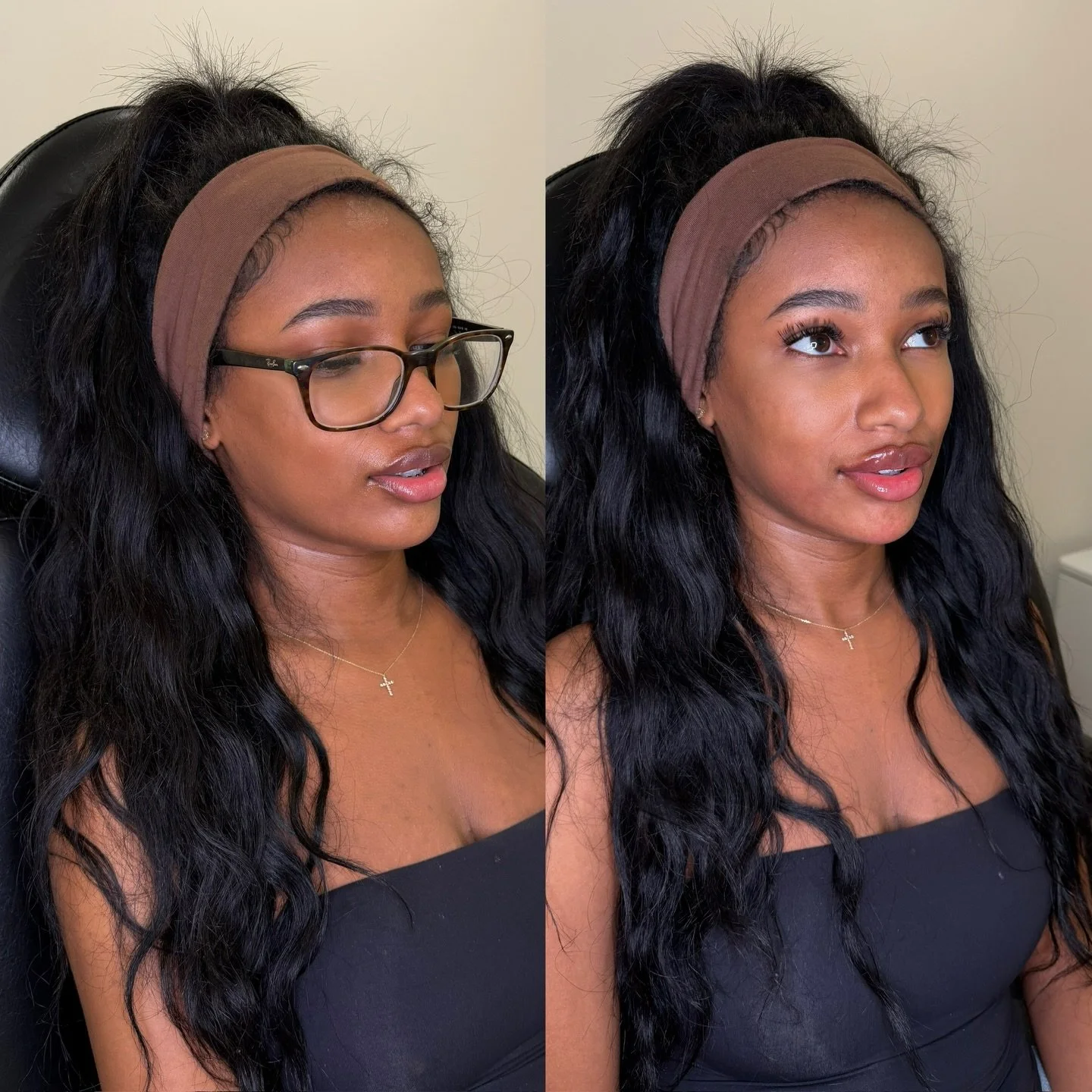 Lip &amp; Chin Filler Maintenance 

Previous filler healed by @plumpedbyemma 

Refresh by @ninapherigo to maintain her baseline 

Tending to the lower face with subtle enhancements connects our face shape. Chin filler provides support for the entire 