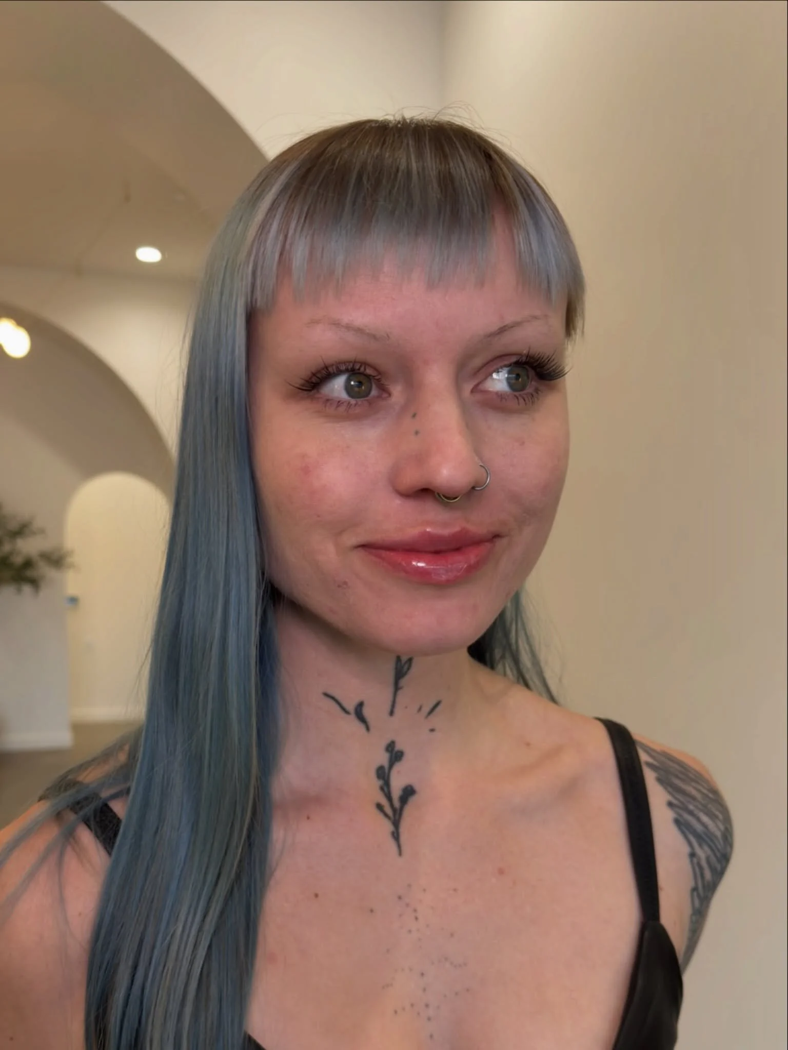 Low-key but impactful lips.

My gorgeous client came to see me for her first ever lip filler appointment.

During our consultation she expressed that she wanted to introduce more vertical height to her lips without overfilling the lateral portions.

