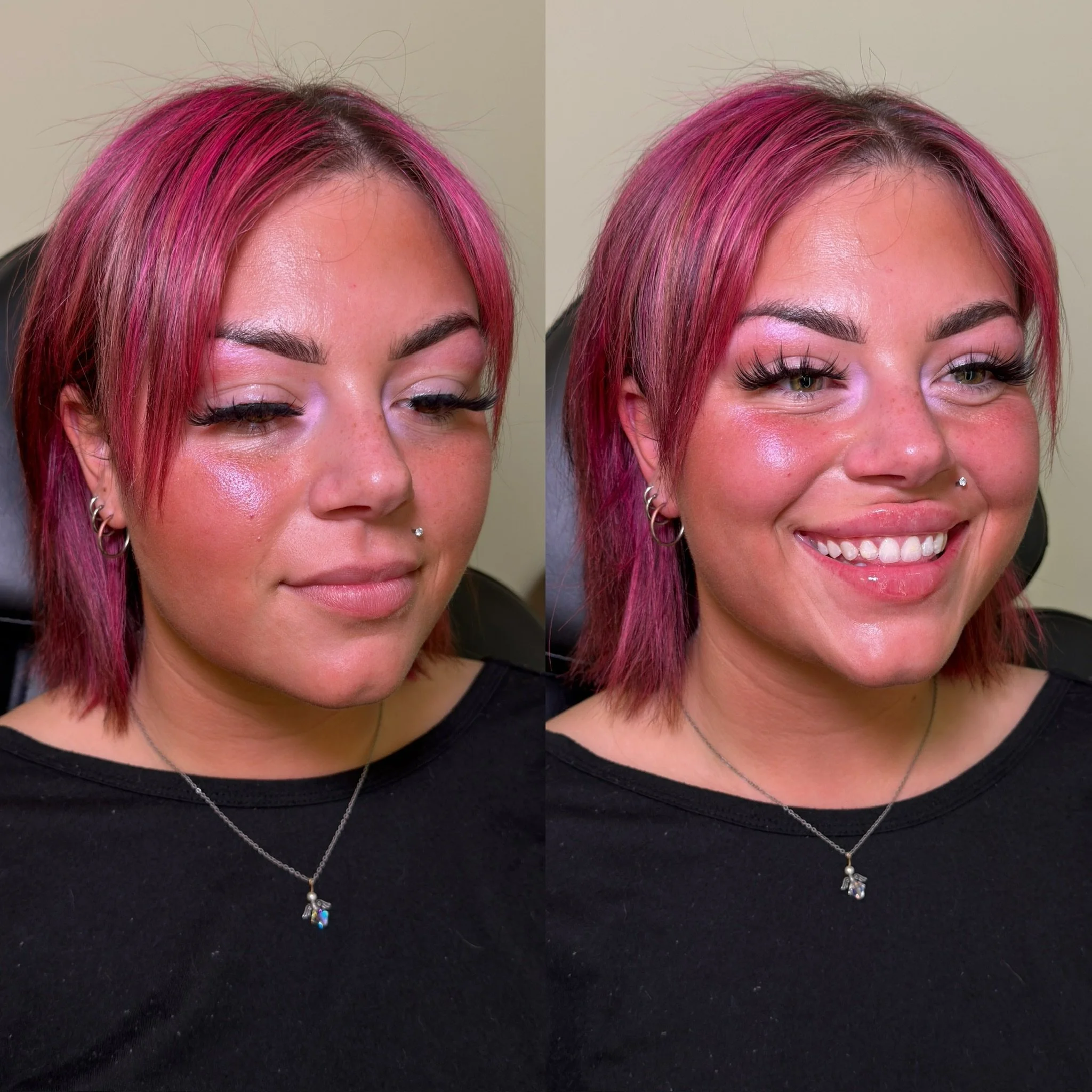 As an injector, there&rsquo;s really no better feeling than when clients return to your chair, placing their trust in your hands, and delivering a result that brings joy.

My sweet client came to see me for her second session of lip filler, building 