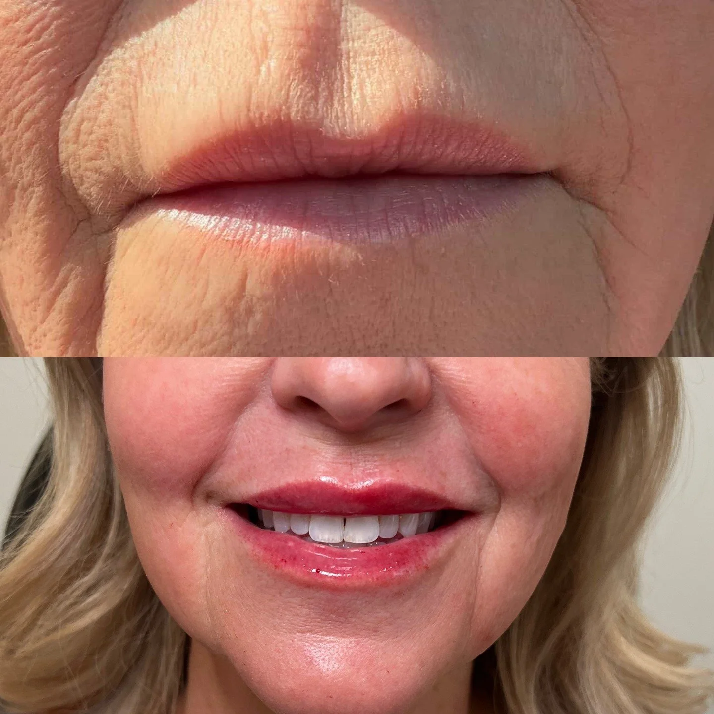 Sometimes a fresh start is needed for results like these. 

Not all filler results are created equally. Results like this would not be possible without dissolving first. It&rsquo;s not stepping backwards, it&rsquo;s moving forward with the best versi