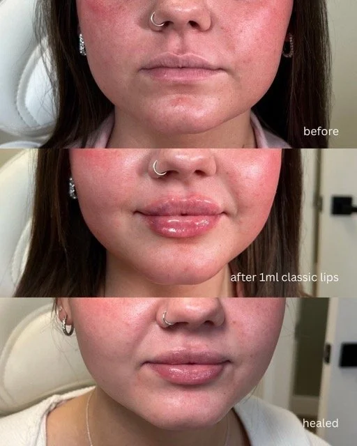 before_compressed_compressed Medium.jpeg