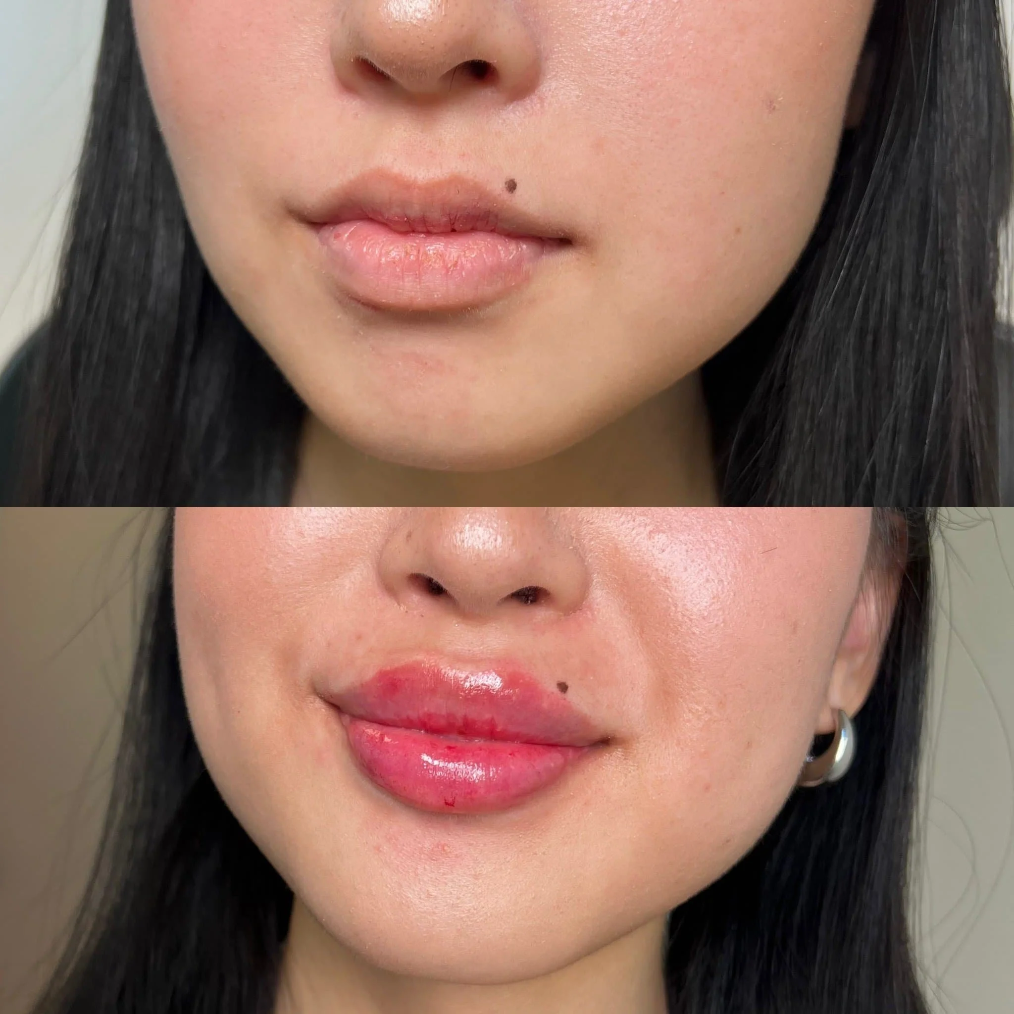 Hands-on aesthetics training at Portland med spa