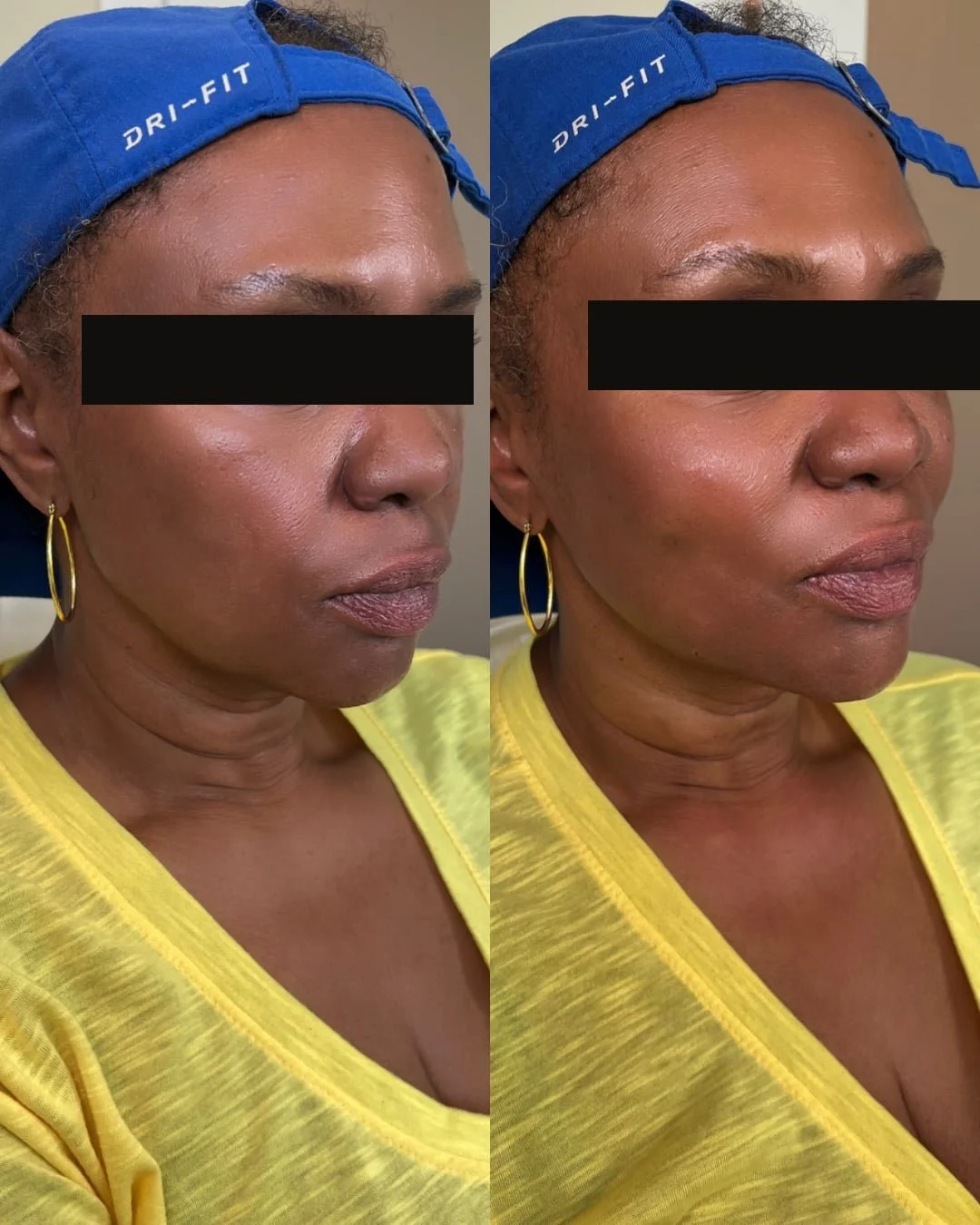 Aesthetic injector training program in Portland Oregon