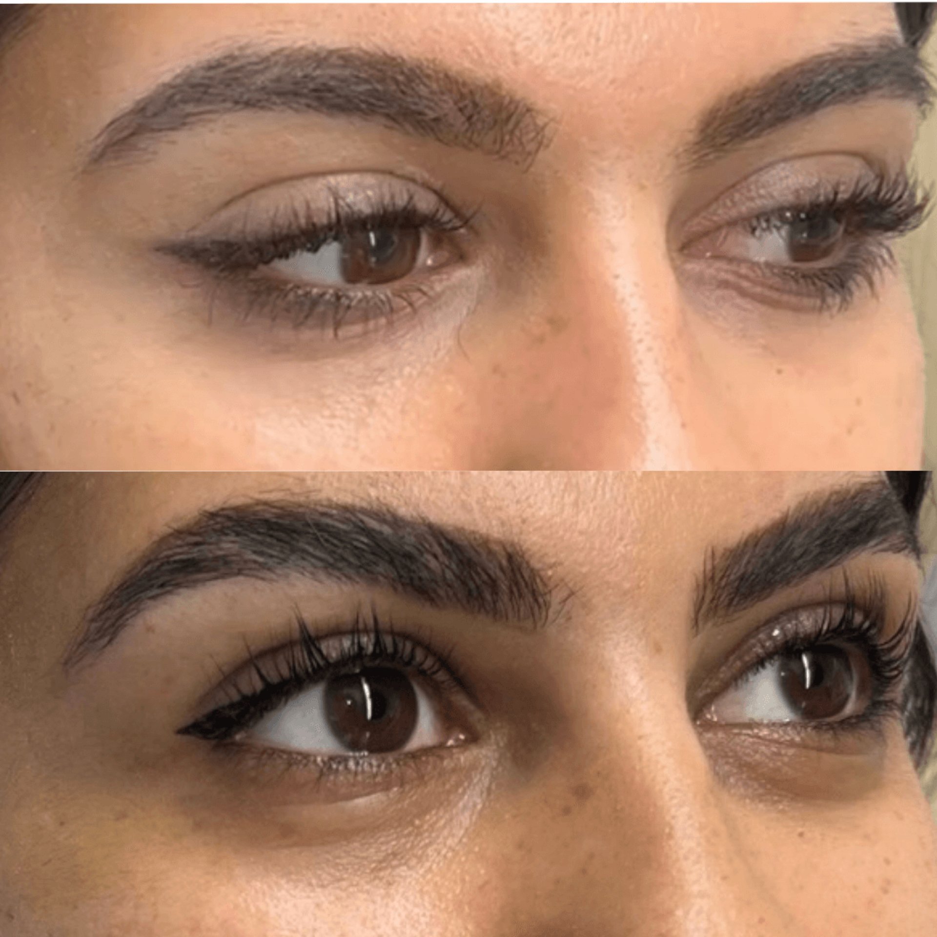 Close-up of a person's face showing their eyebrows, eyes, and skin texture.