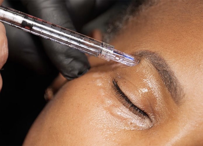 Cosmetic procedure being performed on eyebrow with a syringe.