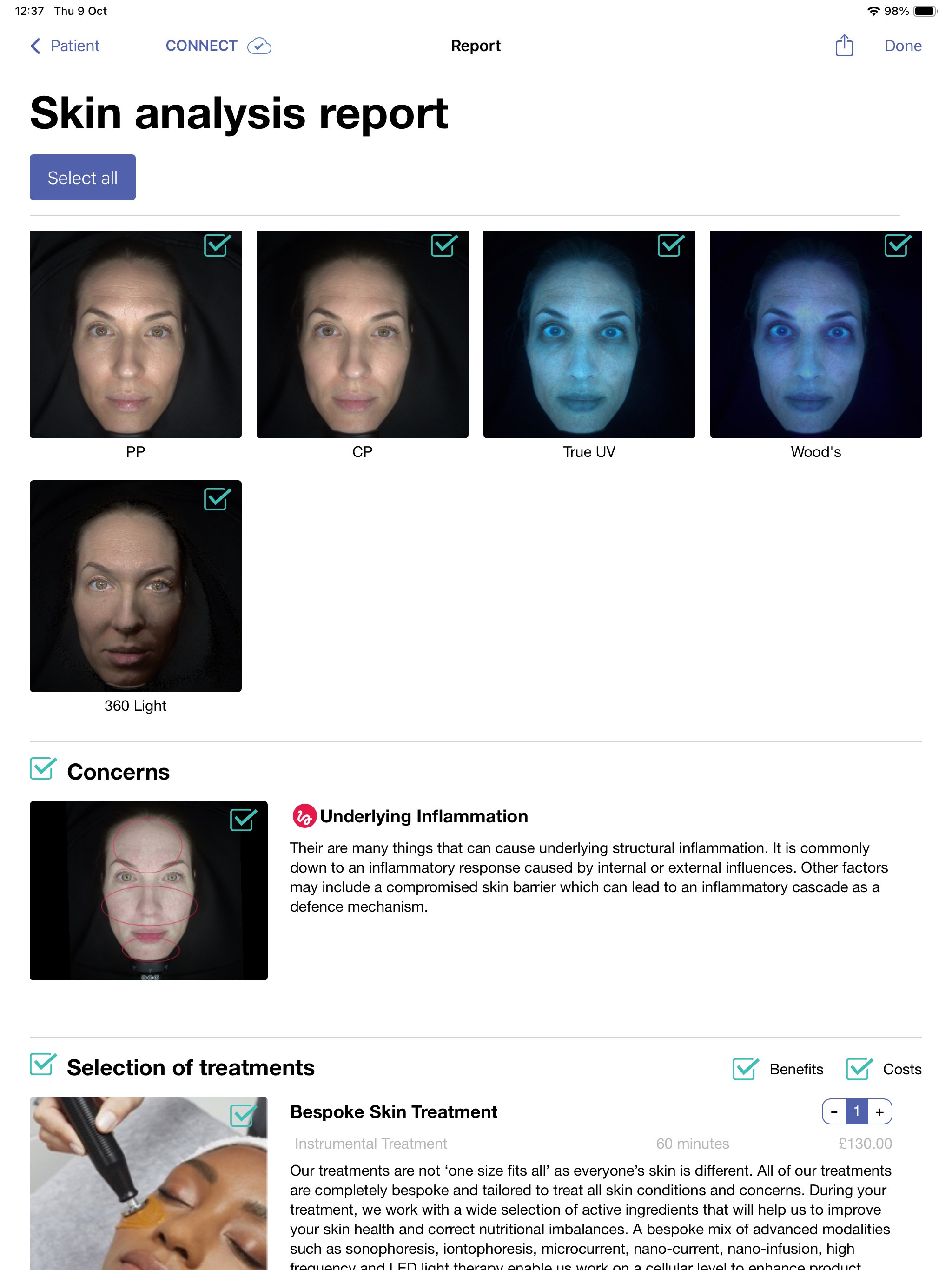 A screenshot of a digital skin analysis report display showing five images of a woman's face under different lighting conditions, labeled as PP, CP, True UV, Wood's, and 360 Light. The report text mentions concerns about underlying inflammation and skin treatment options.
