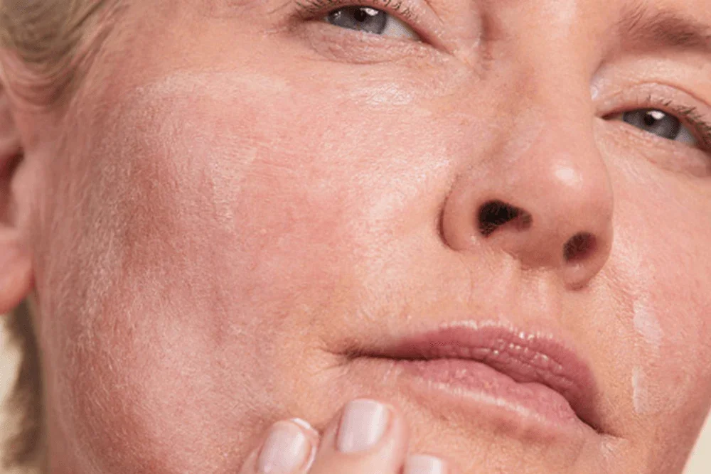 Close-up of a woman's face with clear skin, touching her chin gently.
