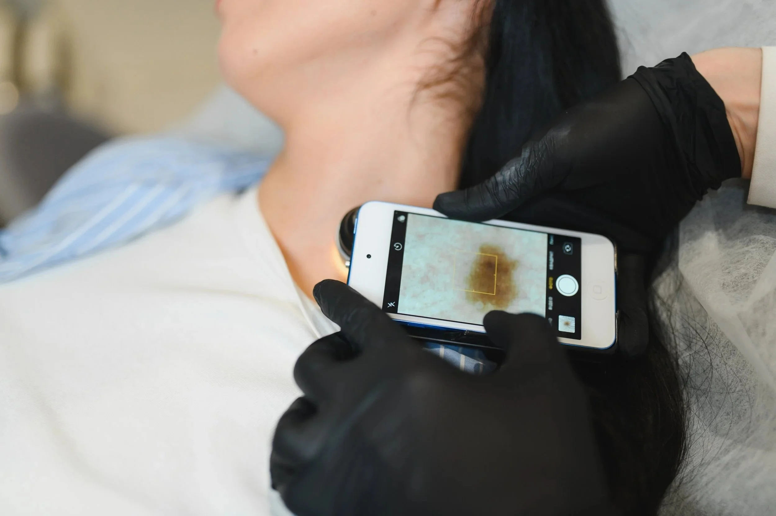 Close-up of a healthcare professional wearing black gloves taking a photograph of a person's arm with a smartphone.