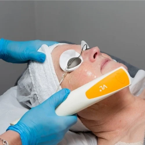 A woman receives a ipl facial treatment with a handheld device, with a gloved practitioner performing the procedure in a clinical setting.