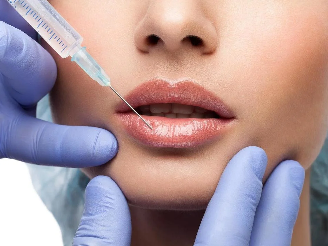 Person receiving a lip injection with a syringe while wearing medical gloves.
