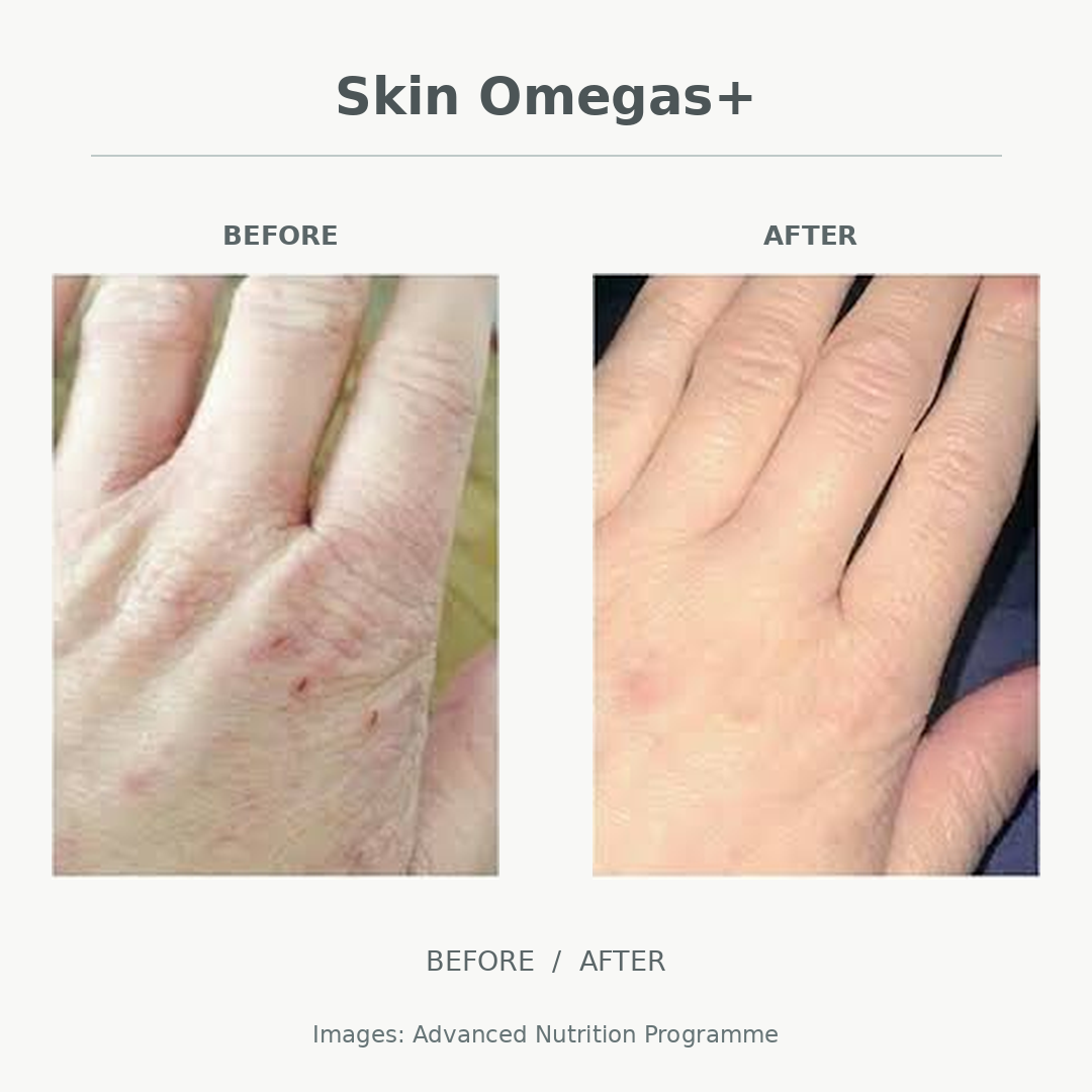 Side-by-side comparison of a person's face before and after skin treatment, showing reduced wrinkles and smoother skin.