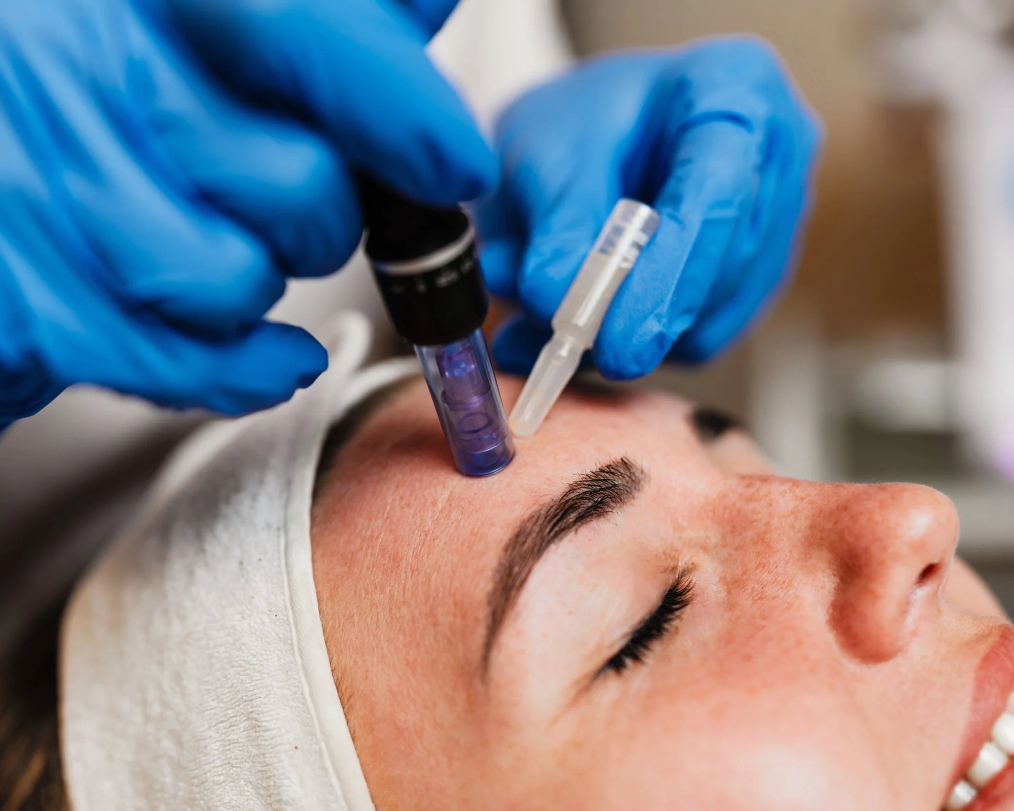 A person receiving a facial treatment with a device near their forehead, wearing protective gloves, and lying down with closed eyes.