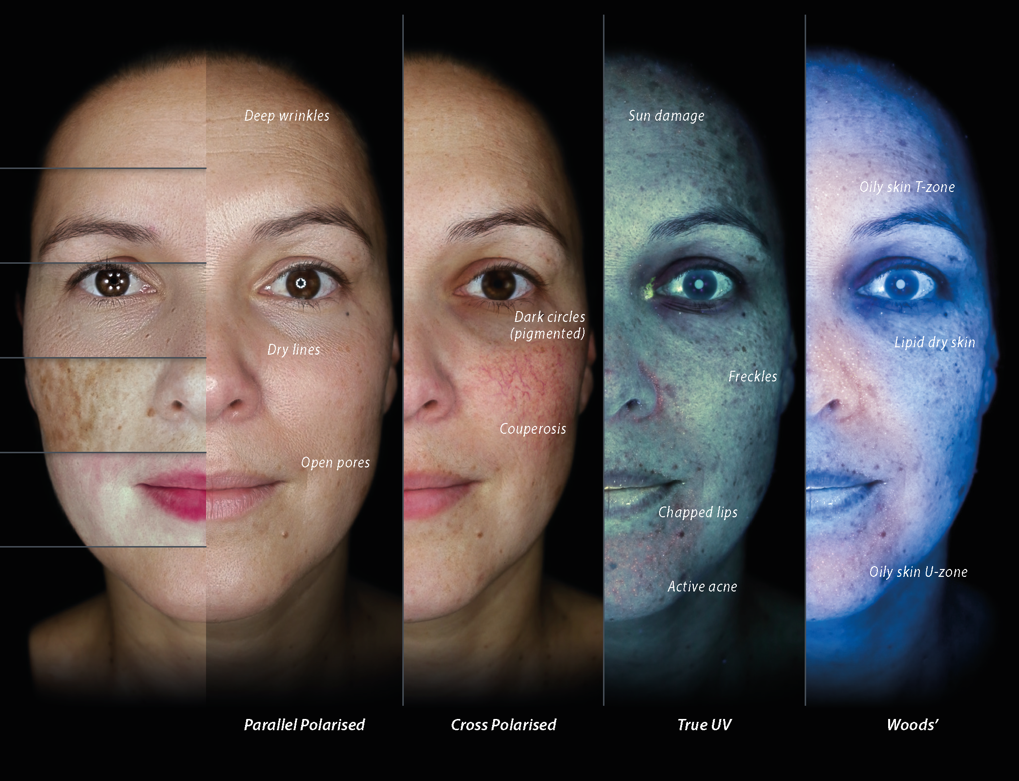 Comparison of different sunglasses lens types showing their effect on facial features and skin appearance.