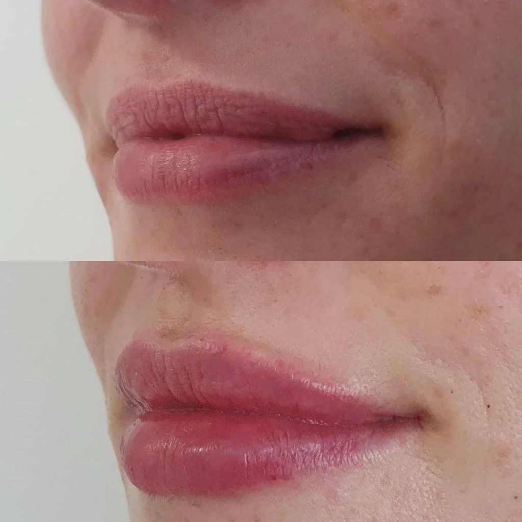 Close-up of lips, with the upper lip slightly parted, showing natural skin texture and light pinkish lip color.
