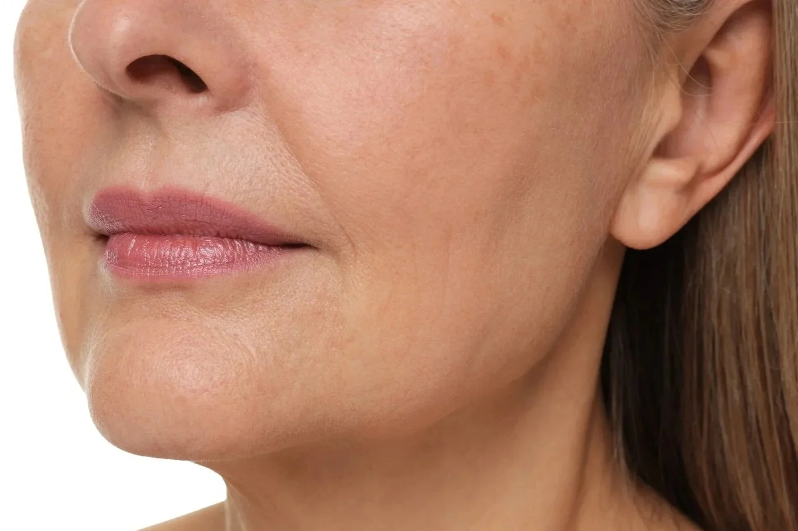 aging skin