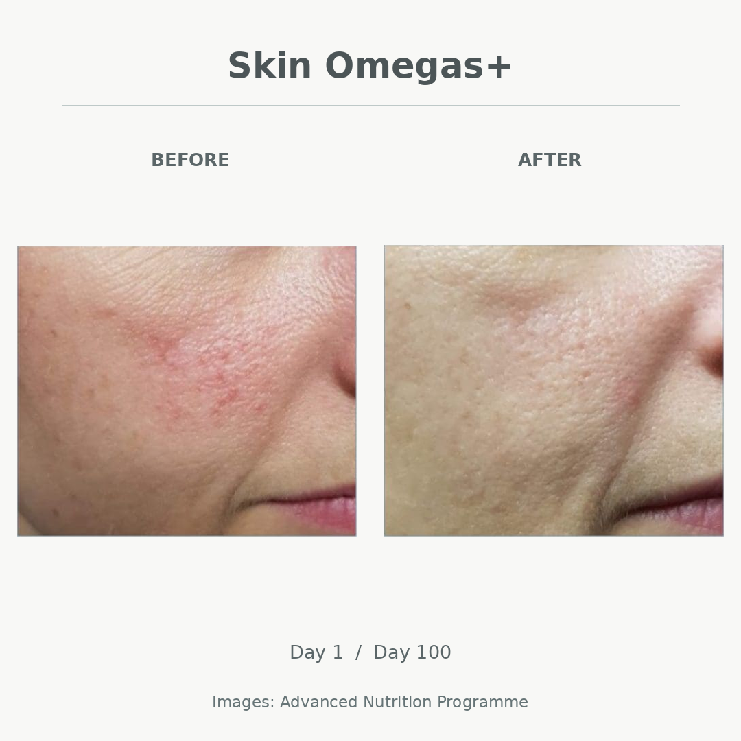 Comparison photo of a woman's face before and after a skincare treatment, showing improvement in skin redness and texture.