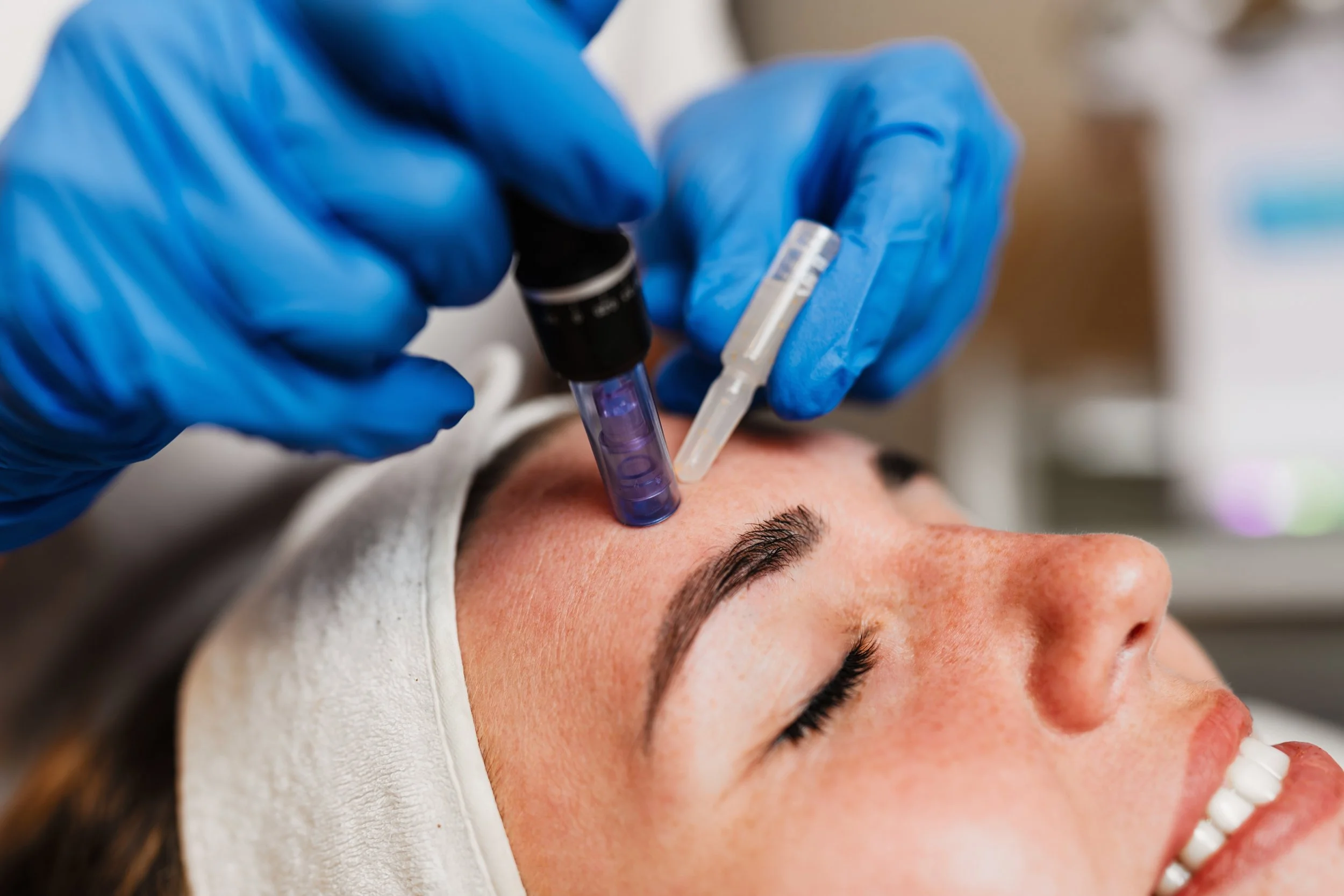Close-up of a woman with closed eyes lying down while a person wearing blue gloves injects a needle into her forehead, likely undergoing a cosmetic procedure.