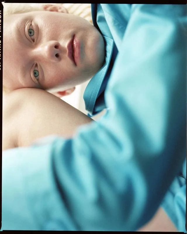 Close-up of a young man with blue eyes lying on his side, wearing a blue medical gown.