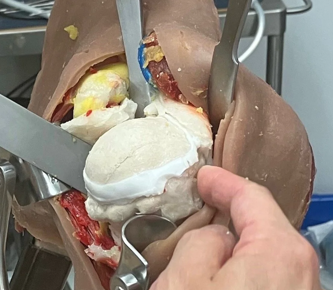 Shoulder arthroplasty training model