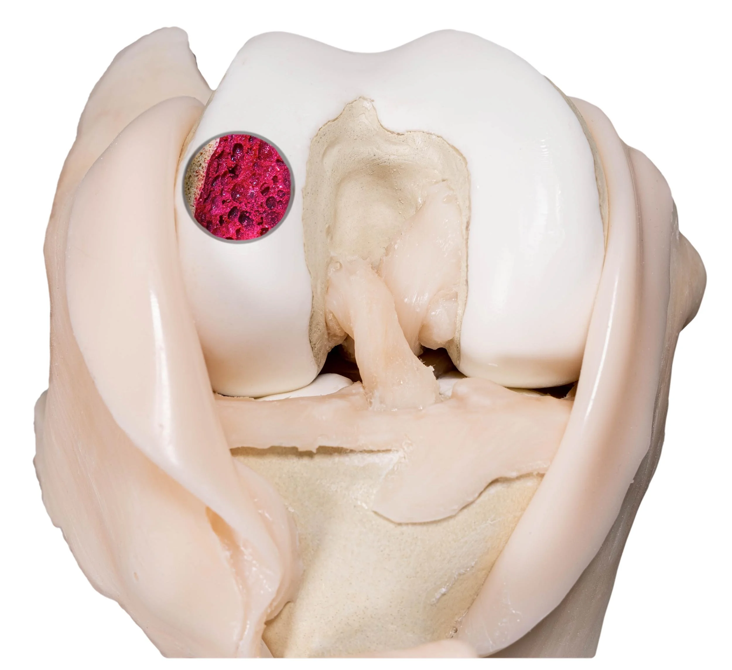 Detailed tactile orthopaedic knee model