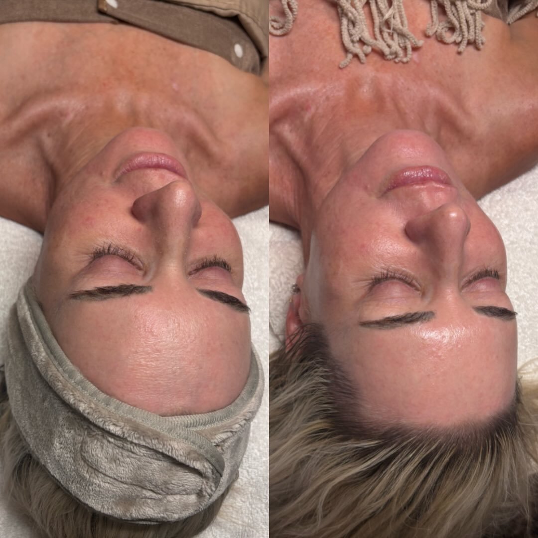 Facials aren&rsquo;t just a one off treatment, they work best as part of a consistent routine, and that looks different for everyone. From adjusting home care to supporting healthy skin between more advanced treatments.

I have clients in the middle 
