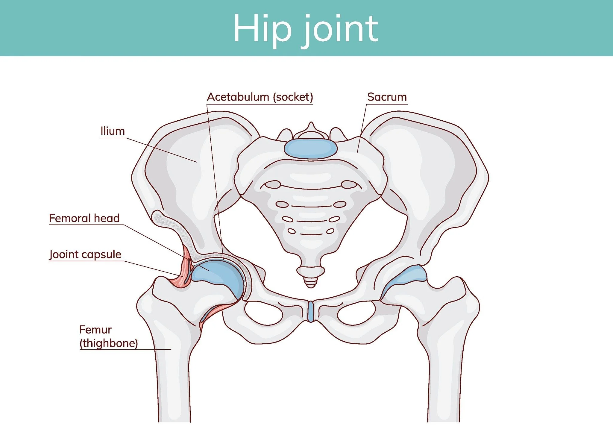 Diagram of the female pelvis highlighting the hip joint, ilium, acetabulum (socket), sacrum, femur (thighbone), and joint capsule.