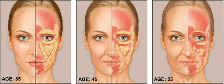 The One Place You Don’t Want to Lose Fat From