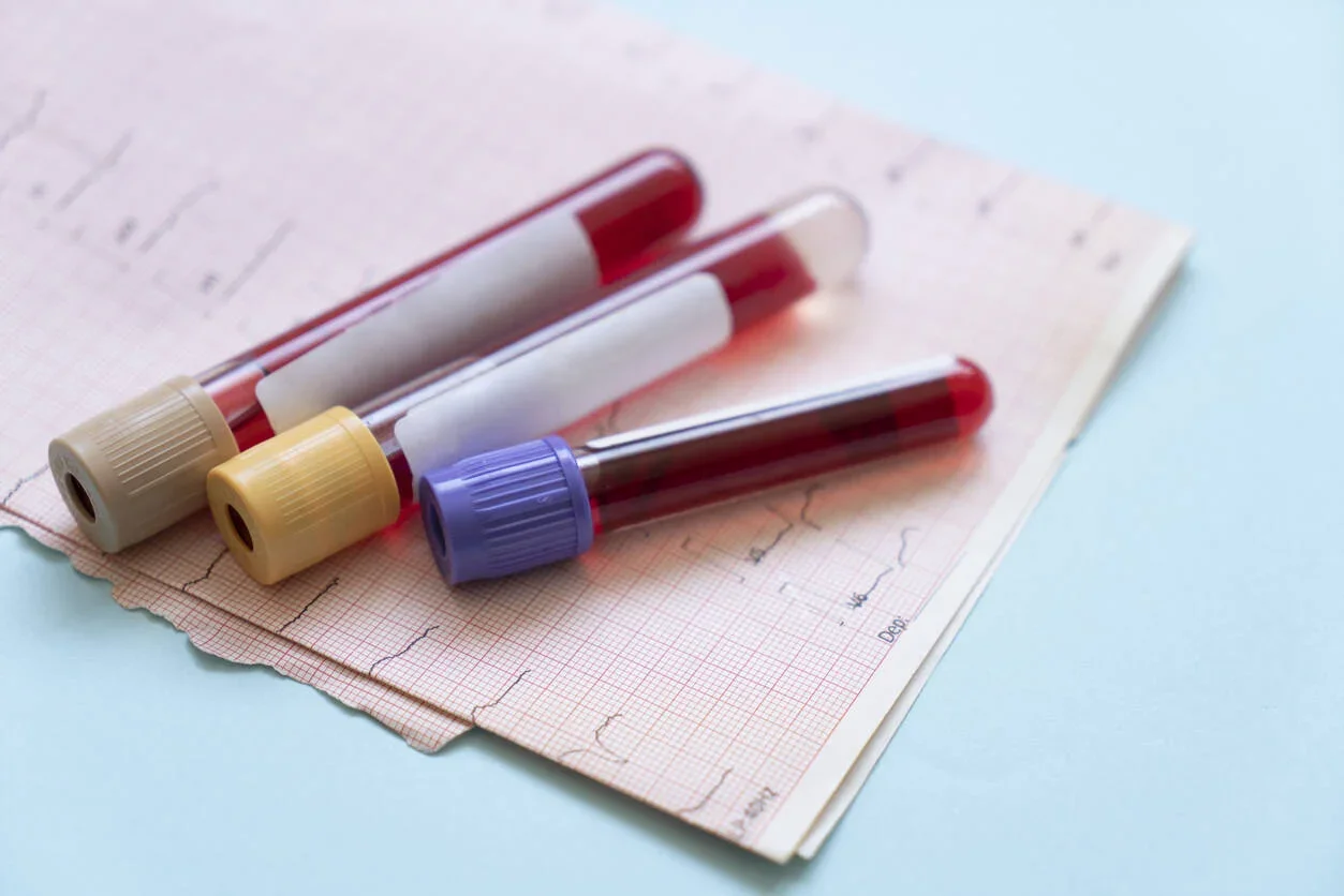 Three blood sample tubes with red caps placed on an electrocardiogram chart.