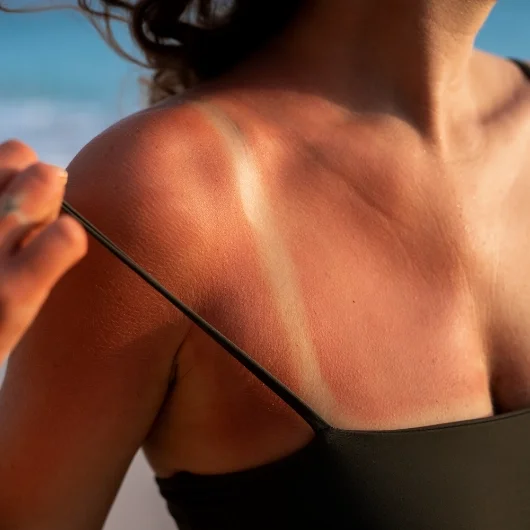Daily protection from sunburned skin with SPF50+