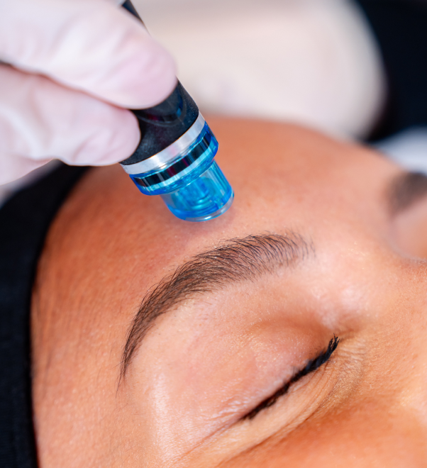 A person receiving Preluma pre-cleansing before Hydrafacial procedure