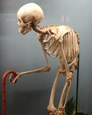 Habits become a health issue love your body make yoga a part of your life&rsquo;s journey 😊