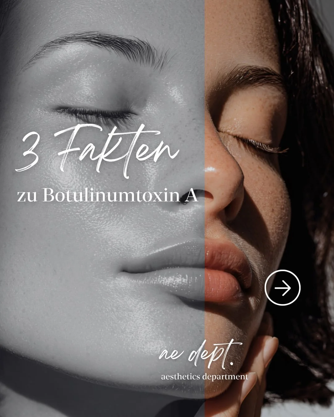 Jede Behandlung beginnt mit einer sorgf&auml;ltigen Analyse und einer klaren Behandlungsstrategie.

So l&auml;sst sich Botulinumtoxin gezielt einsetzen &mdash;
immer orientiert an den individuellen Voraussetzungen.