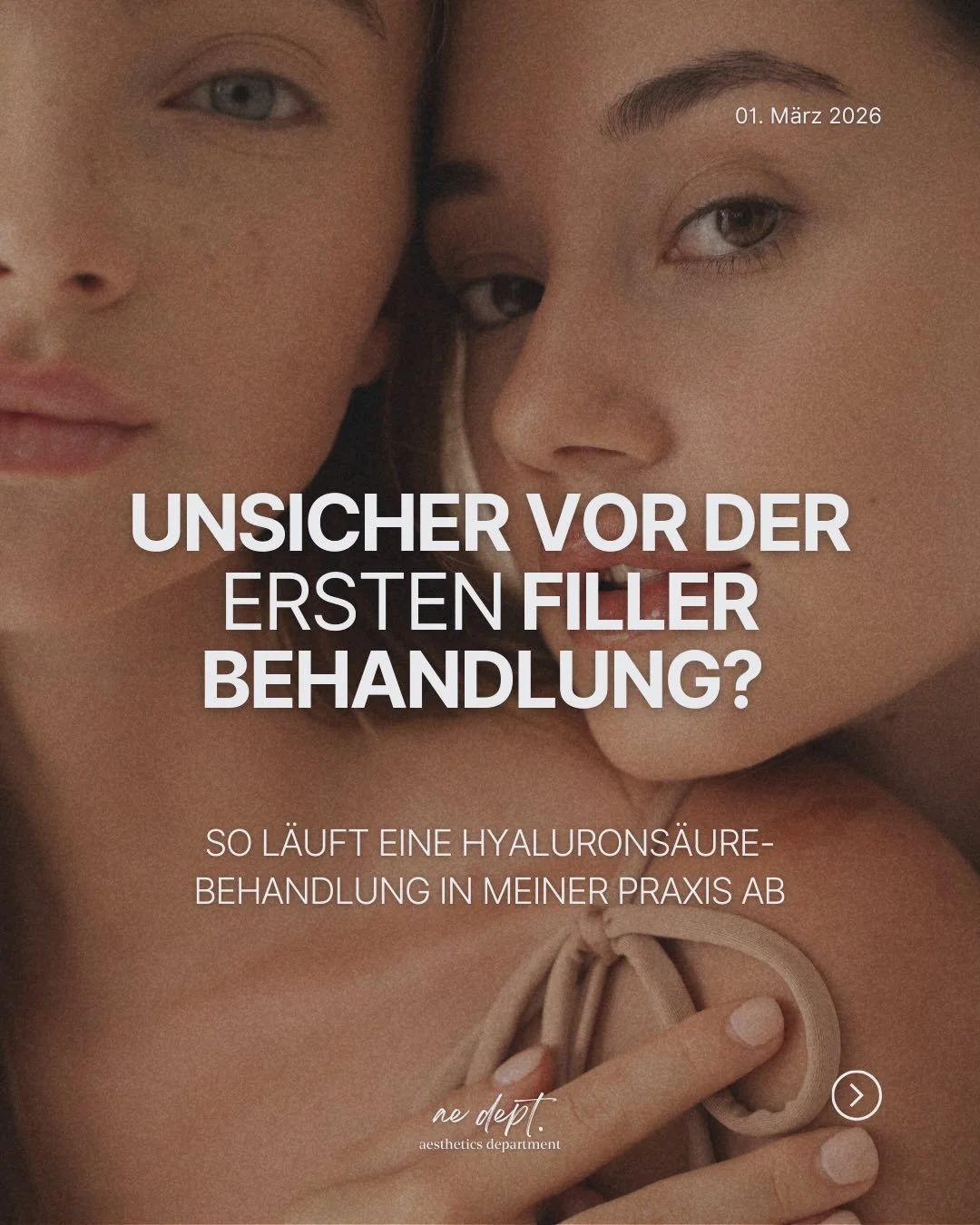 Viele Patient:innen sind vor ihrer ersten Hyalurons&auml;ure-Behandlung unsicher &ndash; und das ist absolut verst&auml;ndlich.

Was passiert genau? Wie viel wird injiziert? Sieht man danach &bdquo;gemacht&ldquo; aus?

In meiner Praxis beginnt jede B