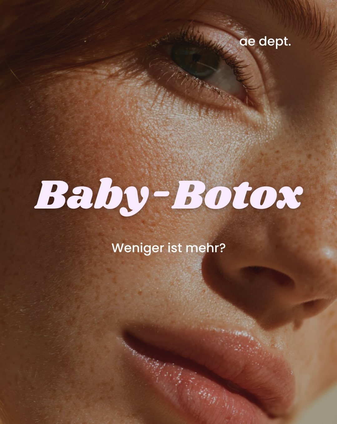 Baby-Botox kann eine sinnvolle Option sein, wenn m&ouml;glichst viel nat&uuml;rliche Bewegung erhalten bleiben soll.
Ob eine geringere Dosierung sinnvoll ist, sollte jedoch immer individuell besprochen werden.

Gerne berate ich dich pers&ouml;nlich z