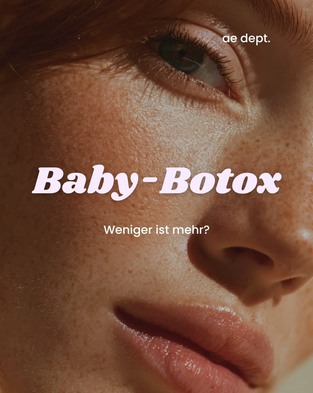Baby-Botox kann eine sinnvolle Option sein, wenn m&ouml;glichst viel nat&uuml;rliche Bewegung erhalten bleiben soll.
Ob eine geringere Dosierung sinnvoll ist, sollte jedoch immer individuell besprochen werden.

Gerne berate ich dich pers&ouml;nlich z