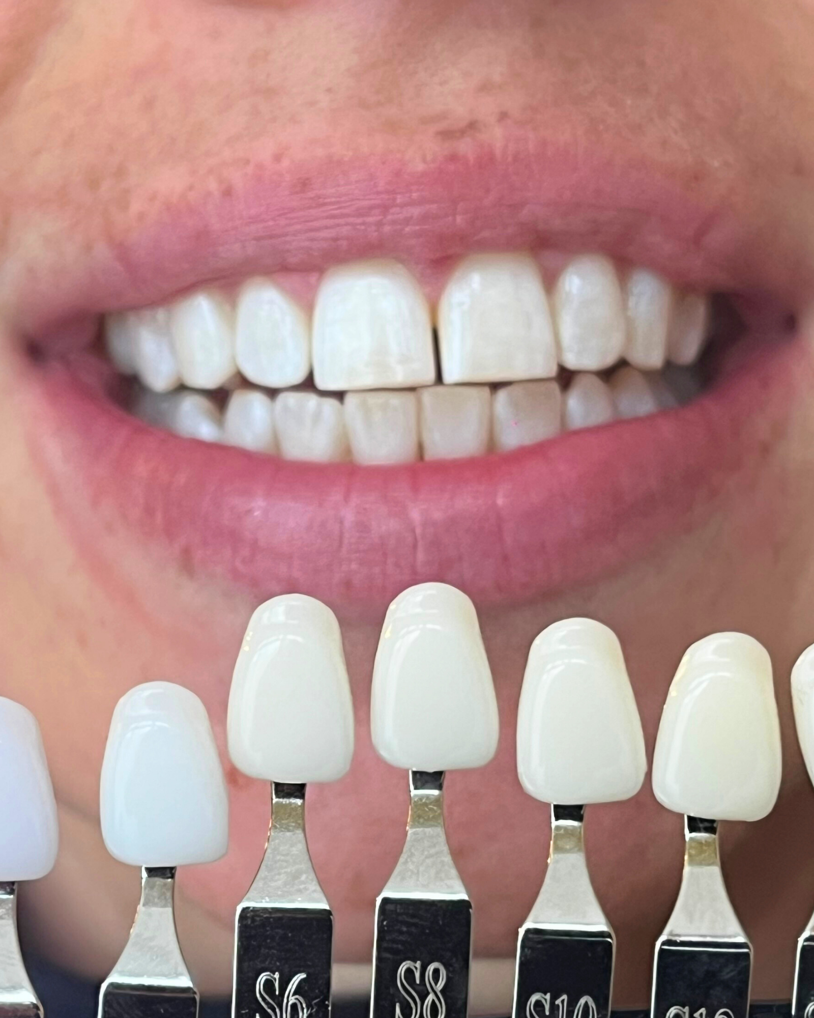 Close-up of a person smiling, showing white teeth, with dark wavy hair partially covering the face.
