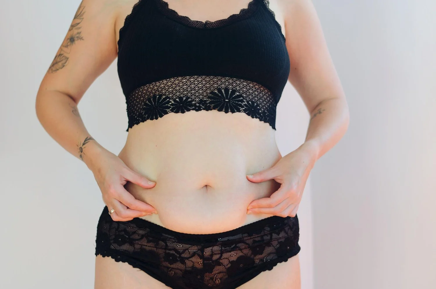 What Makes a Mommy Makeover Different From a Tummy Tuck?