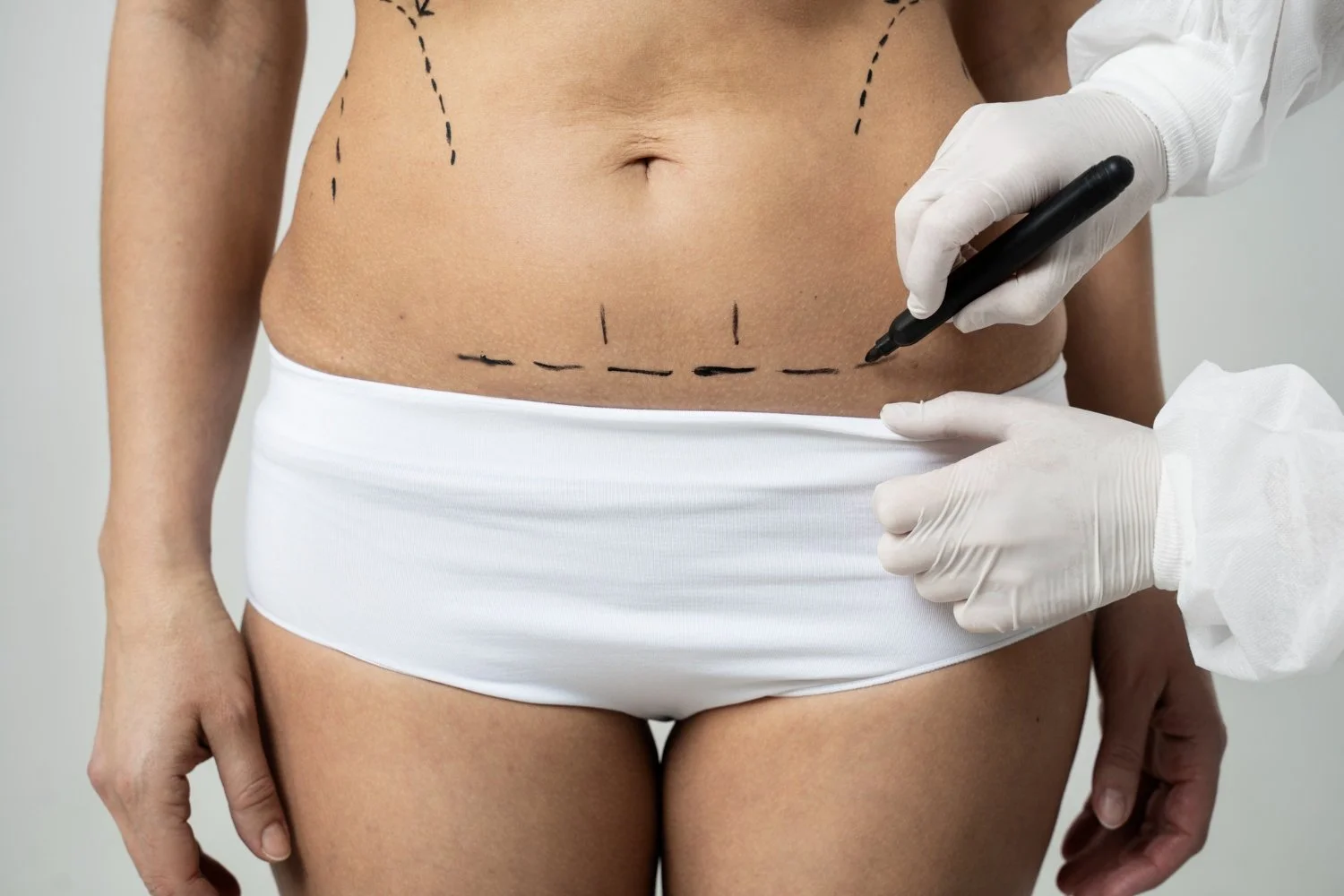 What To Know About Ab Etching Surgery In Orlando And Recovery