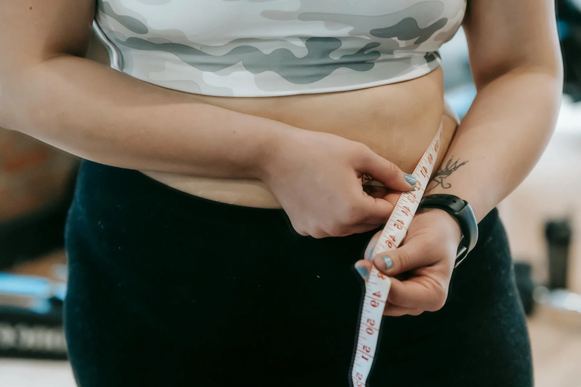 Exploring Effective Liposuction Options In Orlando For Target Areas