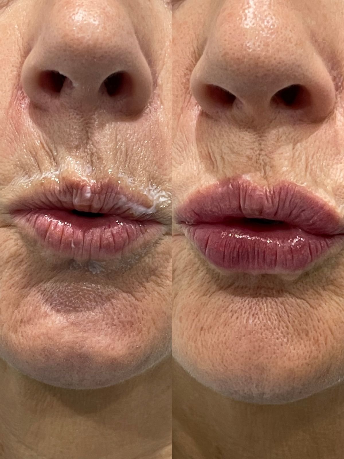 3d81c13a-2772-466b-b7d0-95b10bc12fff.jpg