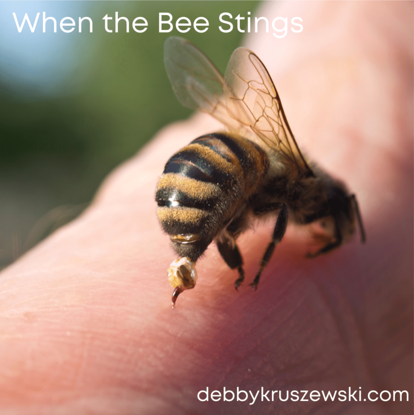 When the Bee Stings