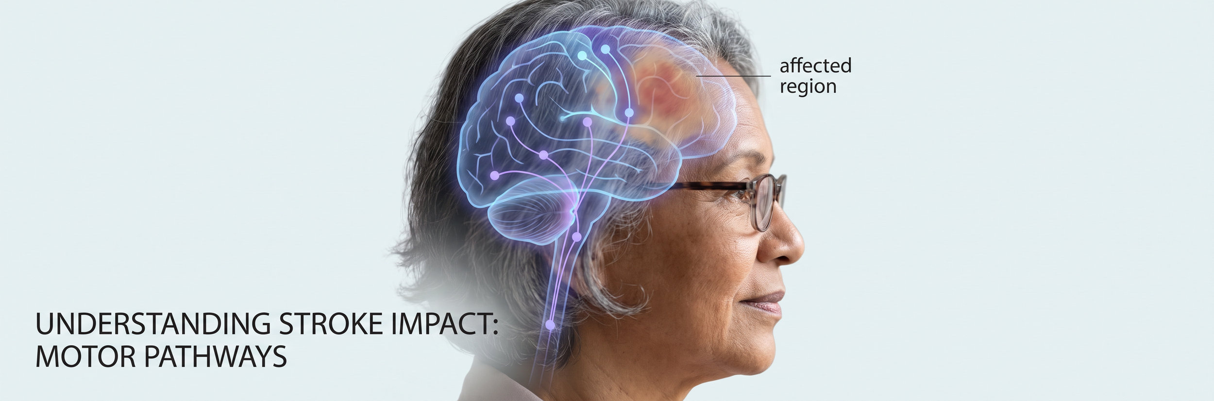Brain illustration showing stroke-affected neural pathways — dysarthria and speech clarity recovery through telehealth speech therapy