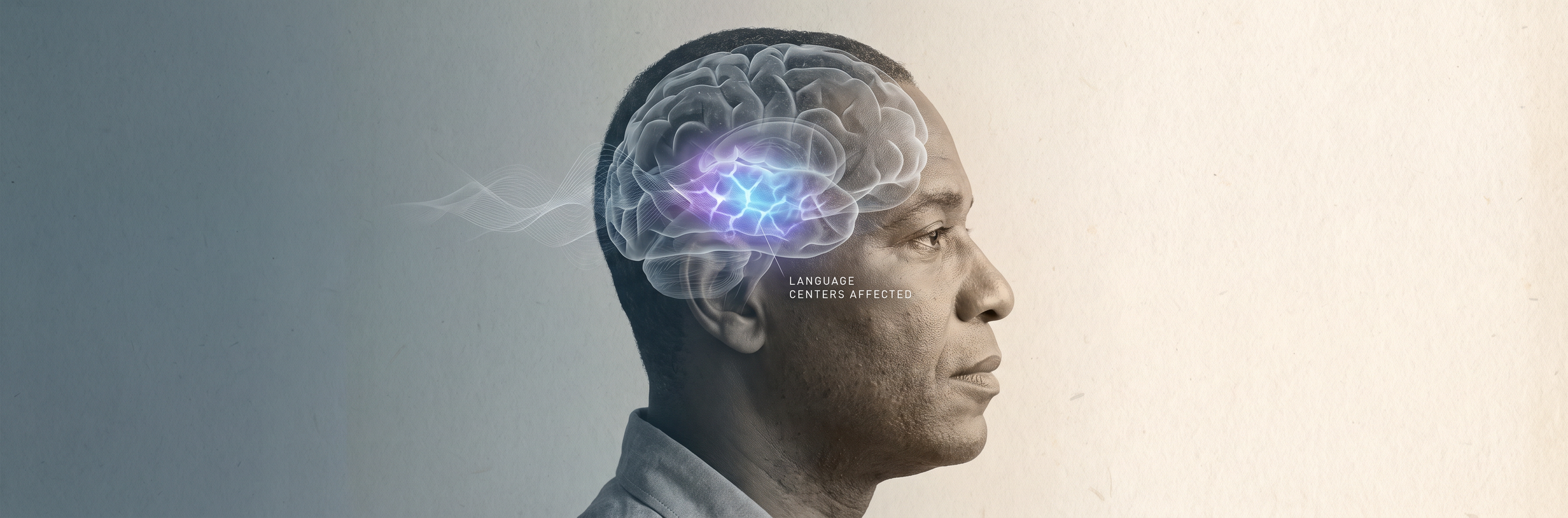 Brain illustration showing language centers affected by stroke or aphasia — speech recovery via telehealth therapy